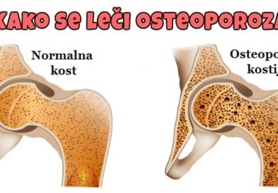 gubitak kostane mase i osteoporoza