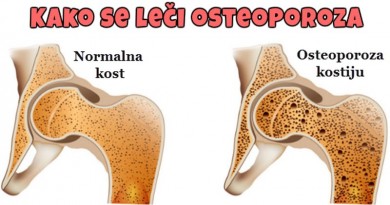 gubitak kostane mase i osteoporoza